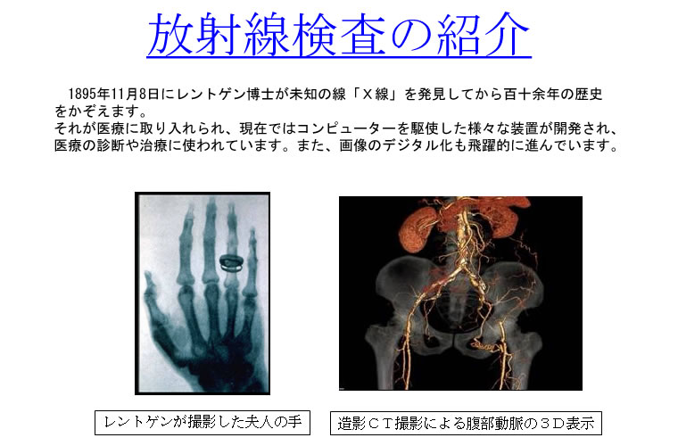 放射線検査の紹介